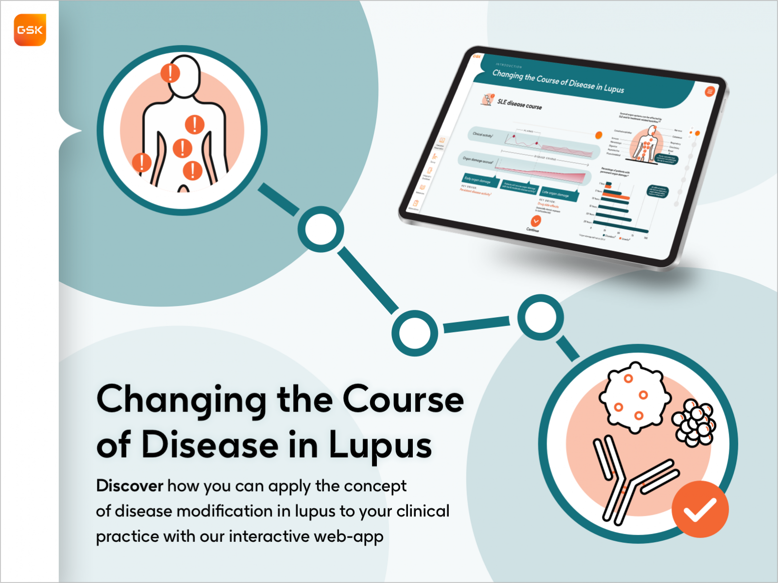 Biologics In Lupus Why Who And When RheumNow   Changing The Course Of Disease In Lupus Case Study Banner Thumbnail 